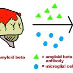 Amyloid beta plaque therapy (grad school presentation); 2002